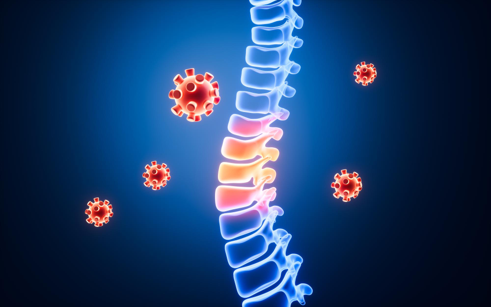 Spine Tumor Specialist In Ahmedabad