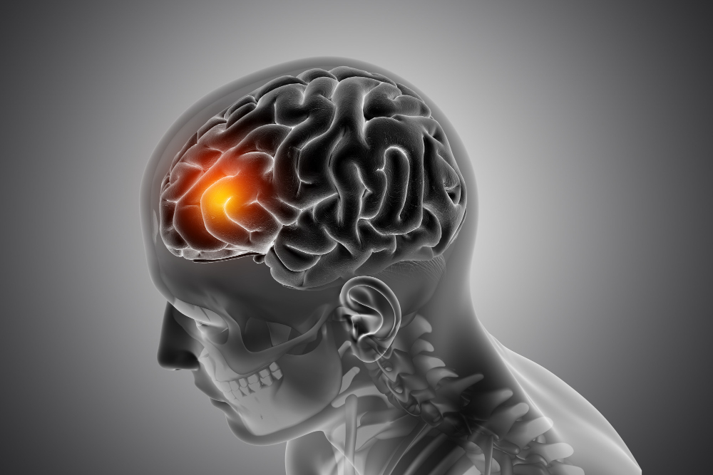 brain surgeon in Ahmedabad